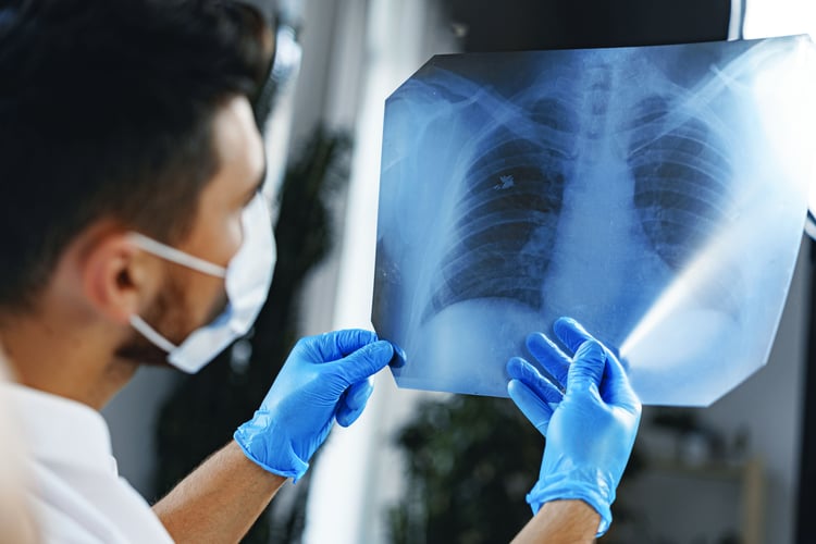 male-doctor-examines-an-x-ray-of-lungs-in-hospital-2021-12-09-11-39-31-utc copia
